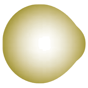 Auge vor Korrektur (Illustration)