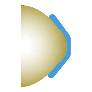 Auge mit Dreamlens (Illustration)