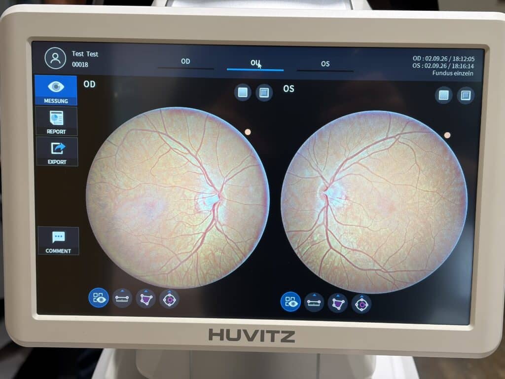 Huvitz HFC-1 Funduskamera – Fundusaufnahme aus unserem Geschäft