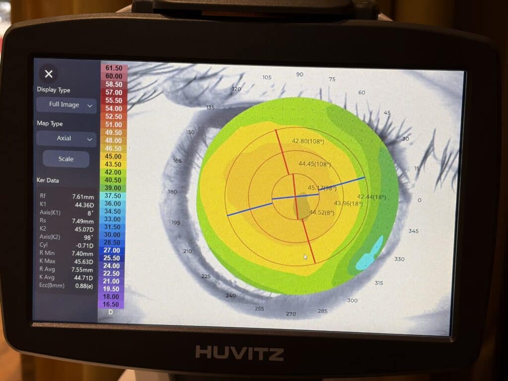 Huvitz HTG-1 Keratograph – Hornhauttopographie aus unserem Geschäft
